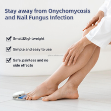 Load image into Gallery viewer, Nail Fungus Laser Device