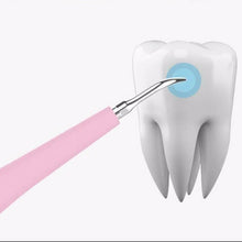 Load image into Gallery viewer, Ultrasonic Tooth Cleaning Wand