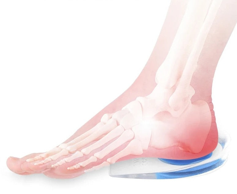 X-ray illustration of a foot with red highlighted heel area resting on a clear silicone gel heel cup