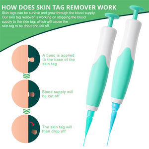 Skin Tag Removal Kit