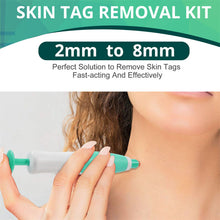 Load image into Gallery viewer, Skin Tag Removal Kit
