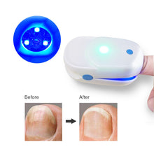 Load image into Gallery viewer, Nail Fungus Laser Device
